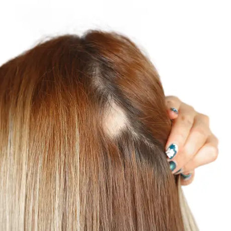 Hair extension services that cover alopecia or trich.
